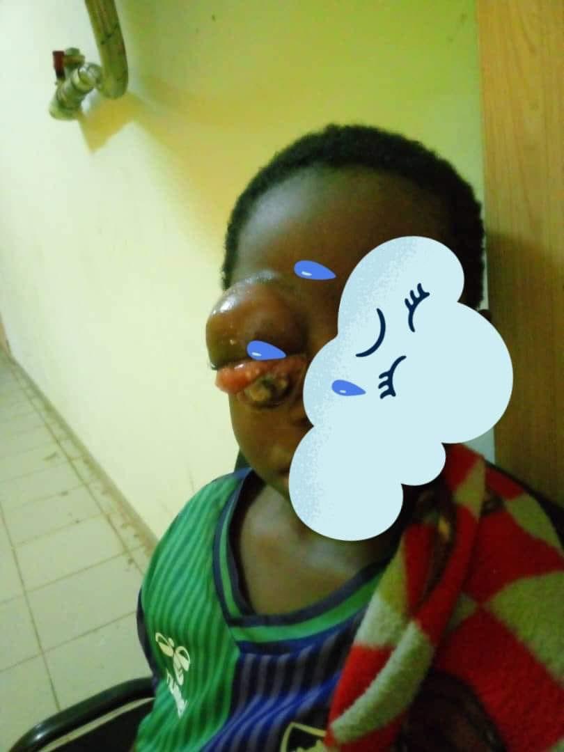 Makhfouss2's tweet photo. 🚨URGENCE

Cet enfant s’appelle Aliou. Il souffre d’un cancer du sang qui a détruit son œil. Il saigne de plusieurs parties de son corps, et sa mère a tout dépensé pour le soigner. Il a besoin de quoi acheter ses médicaments et soulager ses douleurs

🚨OM / Wave : 77 795 27 42 https://t.co/HJpIQDFyPa