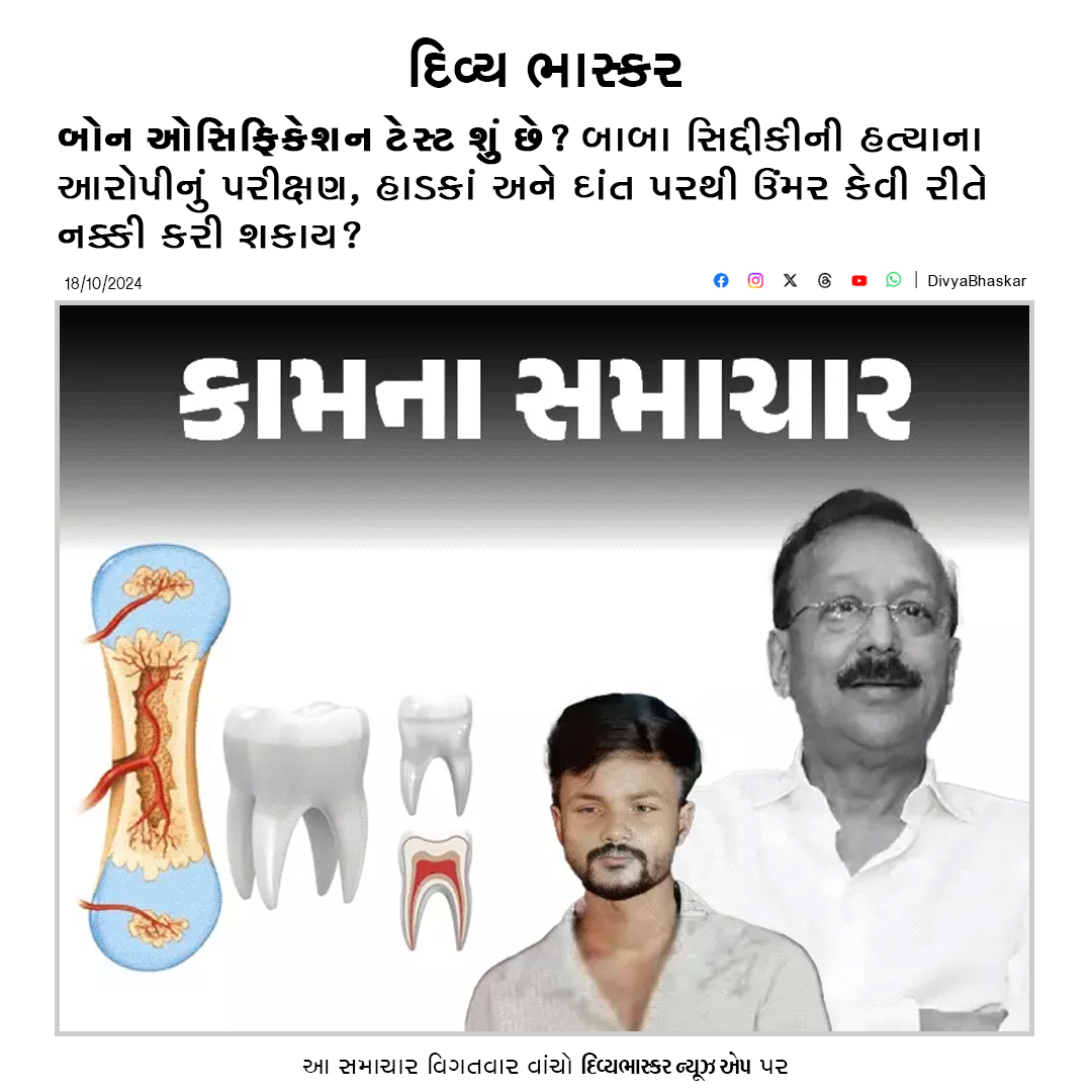 Divya_Bhaskar's tweet photo. બોન ઓસિફિકેશન ટેસ્ટ શું છે? બાબા સિદ્દીકીની હત્યાના આરોપીનું પરીક્ષણ, હાડકાં અને દાંત પરથી ઉંમર કેવી રીતે નક્કી કરી શકાય? - https://t.co/PxFMRIiHwa
#KamnaSamachar #Lifestyle #BoneOssificationTest https://t.co/YM09II8ZMT