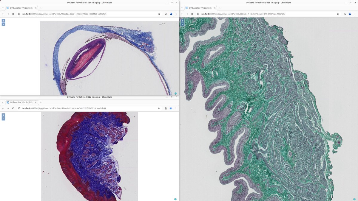 Version 2.1 of the whole-slide imaging plugin for Orthanc has just been released!

This new release brings a huge number of improvements, including better support for the Leica (.scn), Mirax (.mrxs), and Hamamatsu (.ndpi) formats, as well as for sparse tiling. (1/2)