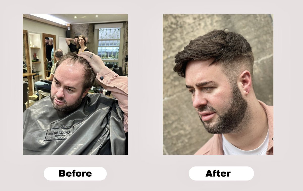 PlayersLounge's tweet photo. Lynn’s client with his new hair system—the results speak for themselves! His confidence is through the roof, and he’s loving his new look so much that he’s already recommending it to his friends. I#HairSystem #Edinburgh #HairReplacement  #HairSystemsForMen https://t.co/n6sgoivjA5