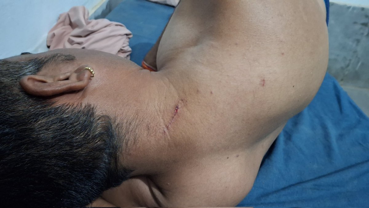 HANUMAN BENIWAL tweet media