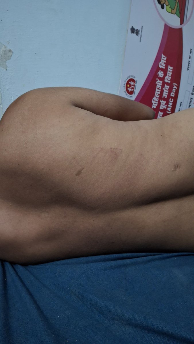 HANUMAN BENIWAL tweet media