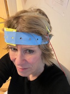 My poor mum and 2 of her siblings got alzheimers at 60
I started stimulating my brain with tDCS 5 years ago      So far-so good

#hjernestim  #tdcs