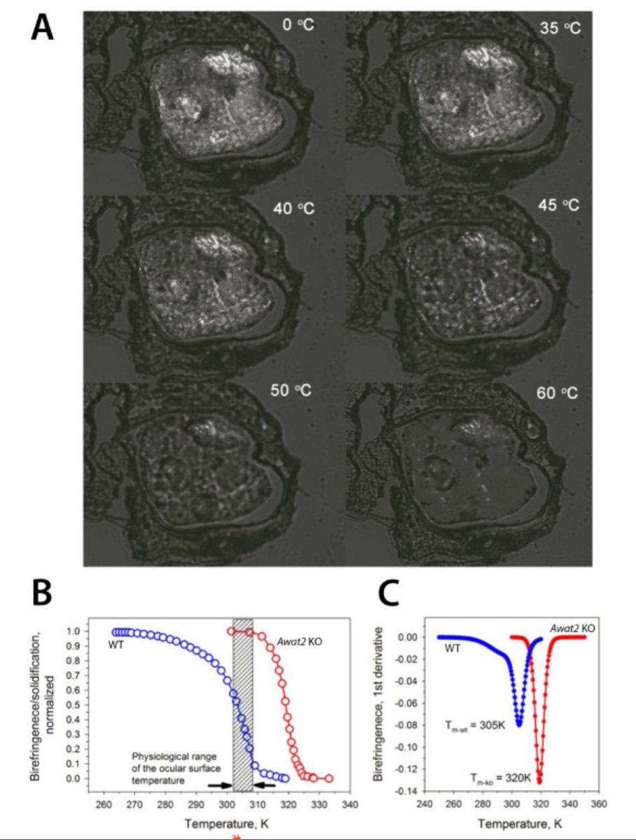 Dr. Sara Thomasy (she/hers) tweet media
