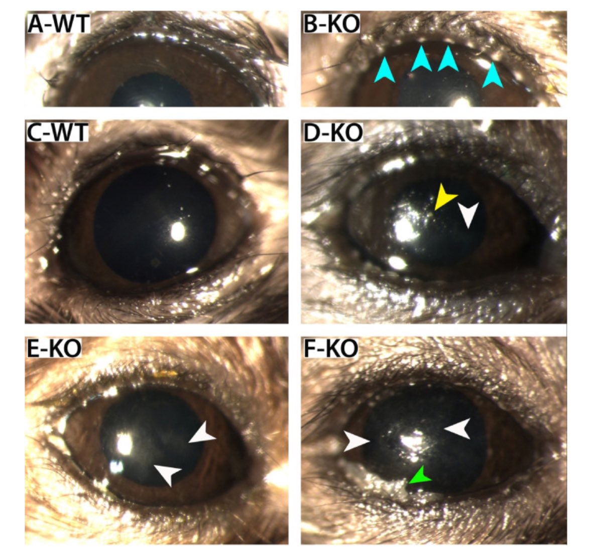 Dr. Sara Thomasy (she/hers) tweet media