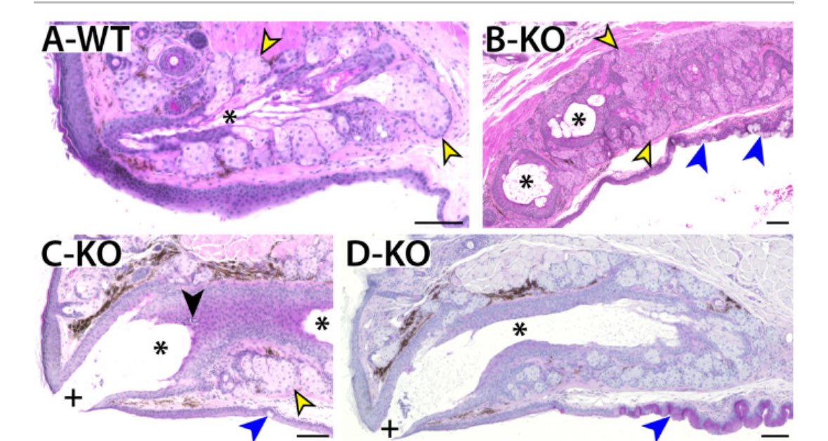 Dr. Sara Thomasy (she/hers) tweet media