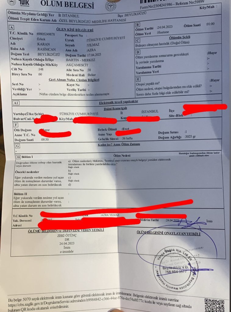 18 ay önce ikiz bebeklerim icin medilife hastanesine doguma gittim. Bebeğim Karanın hidrosefali ve spina bfida hastalıgı vardı. Karanı direkt yogun bakıma cıkardılar göremedim bile hiç. #medilife #beylikdüzümedilife #yenidoğanbebekcetesi