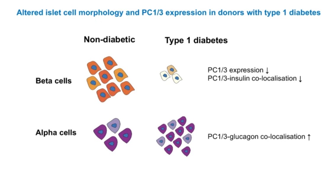 Diabetologia (@diabetologiajnl) on Twitter photo Beta cell prohormone convertase 1/3 (PC1/3) is reduced in T1D <a href="/PaolaS_IDF1/">Paola S. Apaolaza</a> <a href="/YCC_YiChunChen/">Yi-Chun Chen, PhD</a> <a href="/BruceVerchere/">Bruce Verchere</a> <a href="/Teresa_IDF1/">Dr. Teresa Rodriguez-Calvo (DVM, PhD)</a> <a href="/DiabetesnPOD/">nPOD Diabetes</a> <a href="/BCCHresearch/">BC Children's Hospital Research Institute</a> <a href="/HelmholtzMunich/">Helmholtz Munich | @HelmholtzMunich</a> #DiabetesResearch #Islets tinyurl.com/4rkxty6v π Beta cell prohormone convertase 1/3 (PC1/3) is reduced in T1D <a href="/PaolaS_IDF1/">Paola S. Apaolaza</a> <a href="/YCC_YiChunChen/">Yi-Chun Chen, PhD</a> <a href="/BruceVerchere/">Bruce Verchere</a> <a href="/Teresa_IDF1/">Dr. Teresa Rodriguez-Calvo (DVM, PhD)</a> <a href="/DiabetesnPOD/">nPOD Diabetes</a> <a href="/BCCHresearch/">BC Children's Hospital Research Institute</a> <a href="/HelmholtzMunich/">Helmholtz Munich | @HelmholtzMunich</a> #DiabetesResearch #Islets tinyurl.com/4rkxty6v π