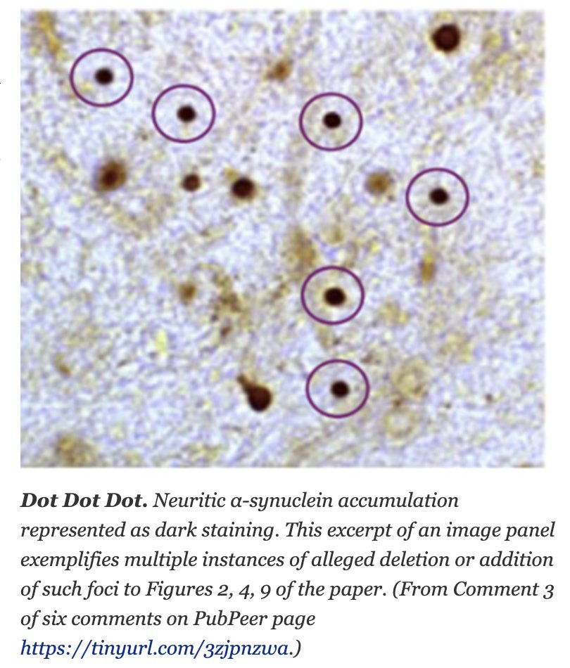 Should we be worried about the falsification of data by NIH Professor Masliah particularly on preclinical models that supported the development of prasinezumab for Parkinson's disease.  Really nicely done article which shows several of the manipulated images. 
"Researchers