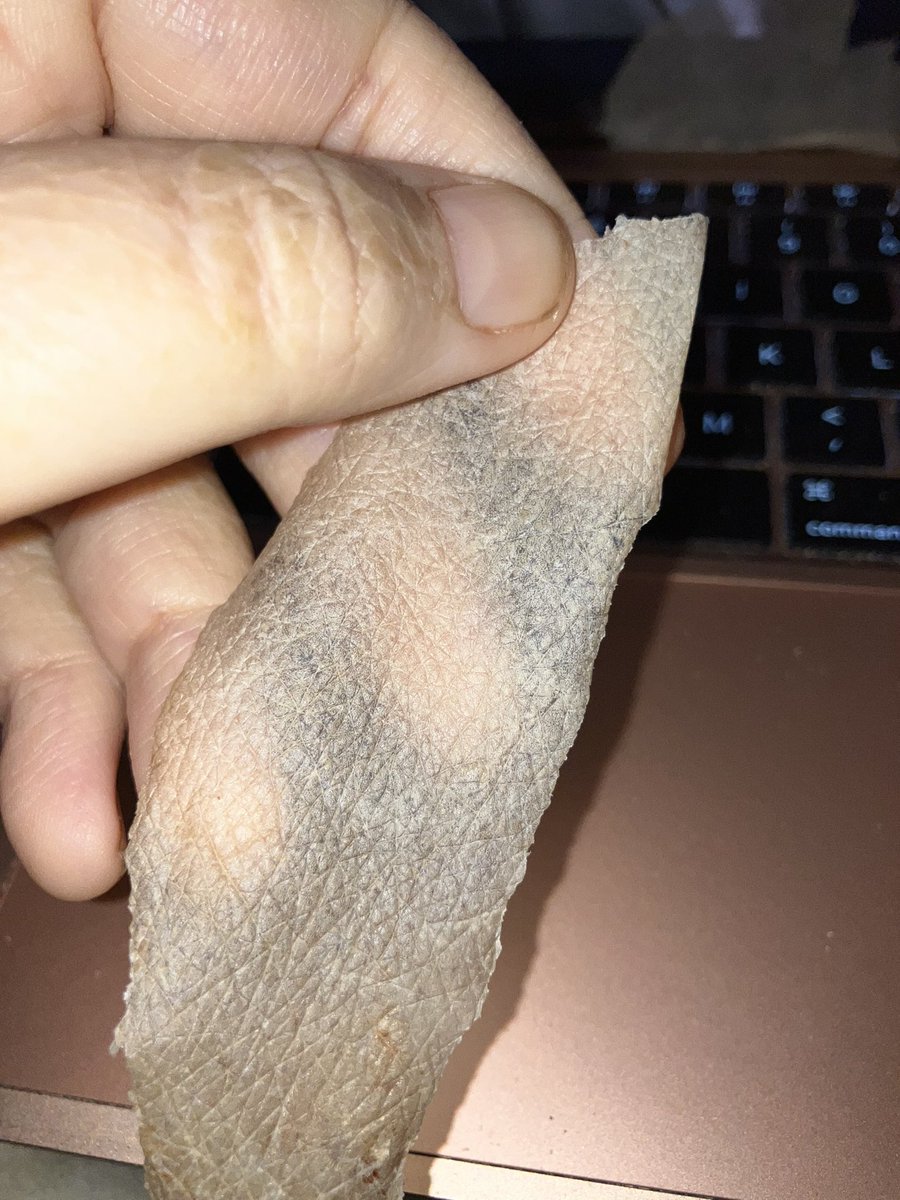 Dymff's tweet image. Mijn huid is wat droog 😬😂 

#ichthyosis