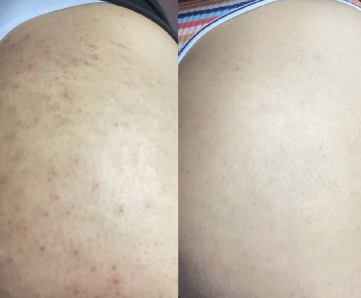 Mary_.9 tweet media
