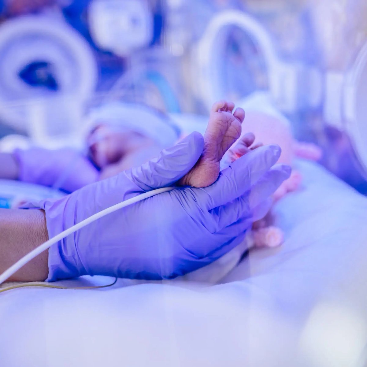 bosunatiklama's tweet image. Türkiye&apos;de, yenidoğan yoğun bakım yataklarının üçte ikisinin özel hastanelerde olduğu öğrenildi.