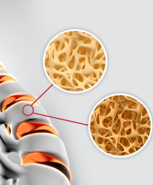 ejustin46's tweet image. &quot;Long-term effects of COVID-19 infection on BONE MINERAL DENSITY&quot;

jogh.org/2024/jogh-14-0…