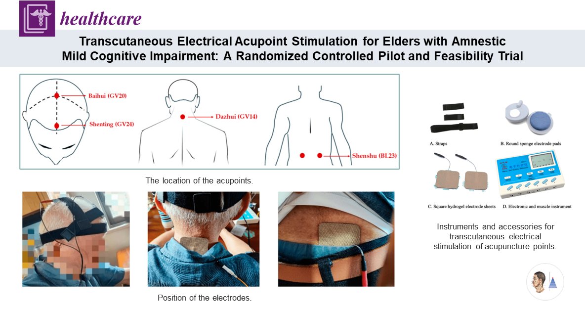 ⚪Étude pilote randomisée 🇨🇳
📰Healthcare
Troubles cognitifs légers amnésiques du sujet âgé. Évaluation de l’efficacité de l’électroacupuncture de surface + éducation de santé [ES] 𝑣𝑒𝑟𝑠𝑢𝑠 [ES] seule. ↗ fonction cognitive [MoCA].

pubmed.ncbi.nlm.nih.gov/39408125/🔓