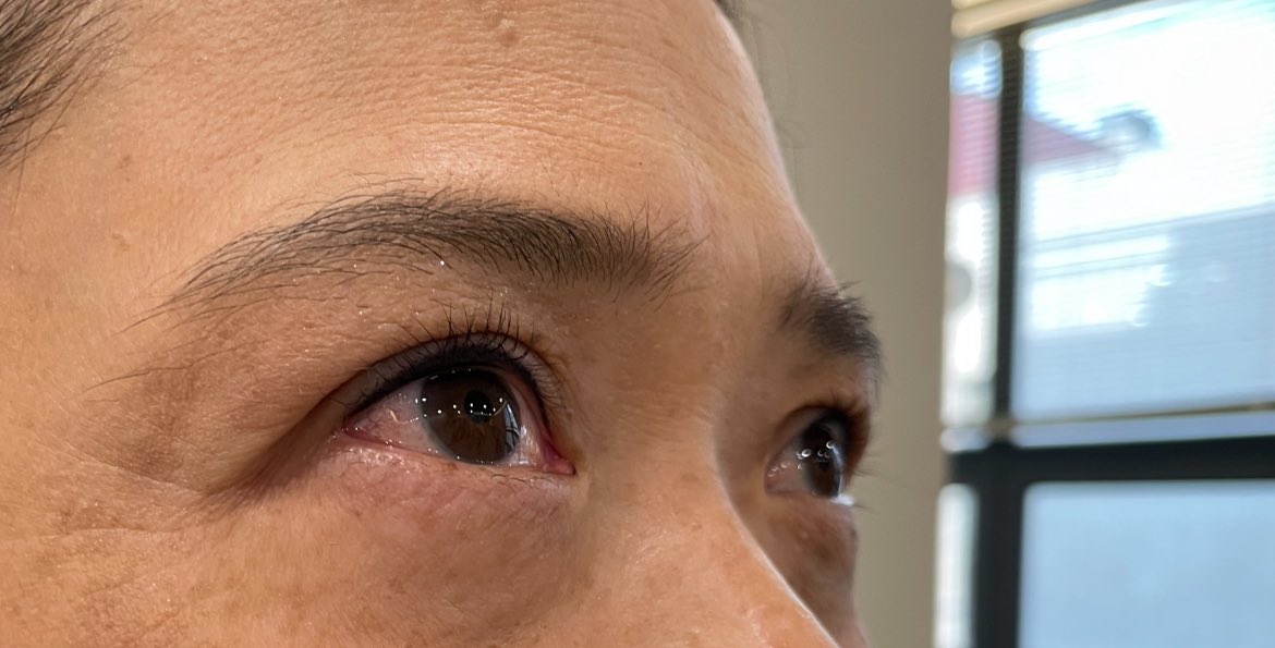 アイラインのアートメイクに初挑戦💦
ドキドキしたけど、院長先生も優しくて、とても丁寧にして頂きました。
#Nami_brow