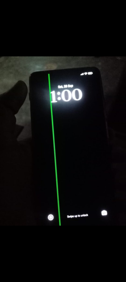 Suryans0417's tweet photo. Xiaomi has played well here by pushing cheap updates due to which I'm facing greenline issue on my display.
@MiIndiaSupport @XiaomiHyperOS_ @ShokeenSanchit...
Now giving me estimate of Rs.9414.
True Biasness..👏👏
I think it's a curse to be a Xiaomi user... https://t.co/IfzDIkoB5n