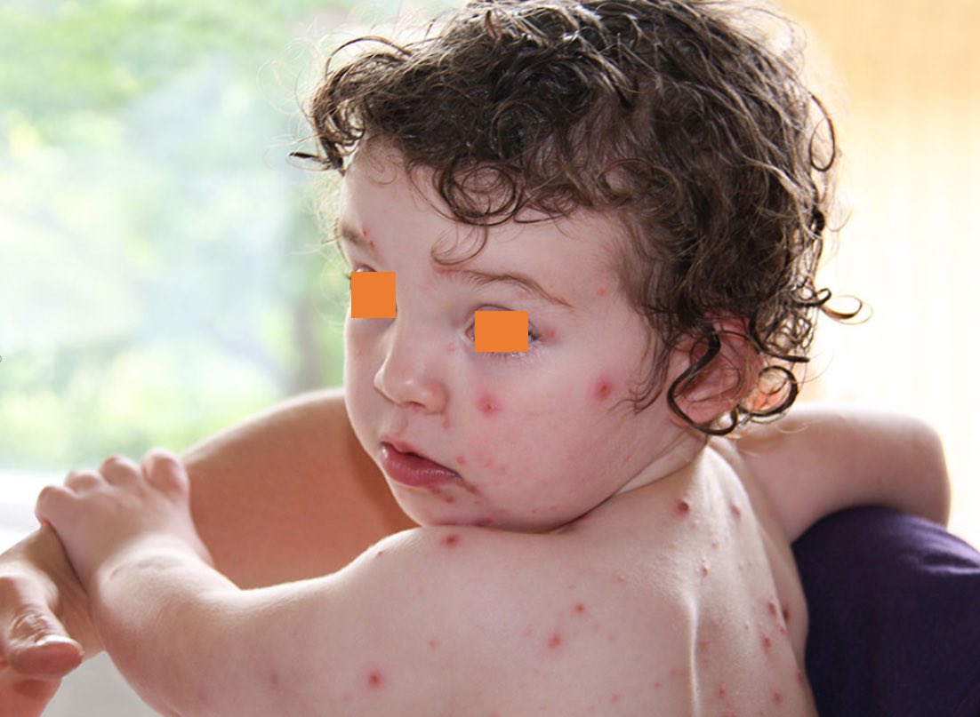 Dr Ihab Suliman tweet media