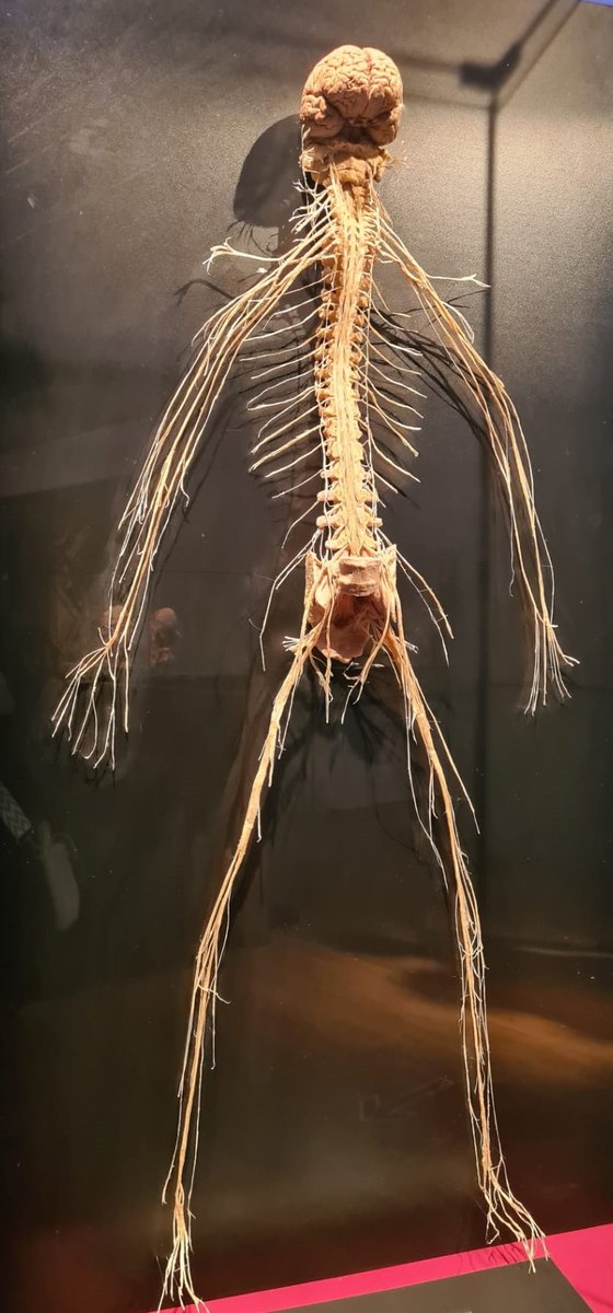 fibro_fairy's tweet photo. I went to #BodyWorld today and finally met the culprit of our pain—the nervous system!🧠👀🤓
If I could, I'd lock it up for all the #pain it's causing… but it’s already in a glass jail!😅
#Fibromyalgia #ChronicPain #InvisibleIllness #advocate https://t.co/ij9L3UF4hP