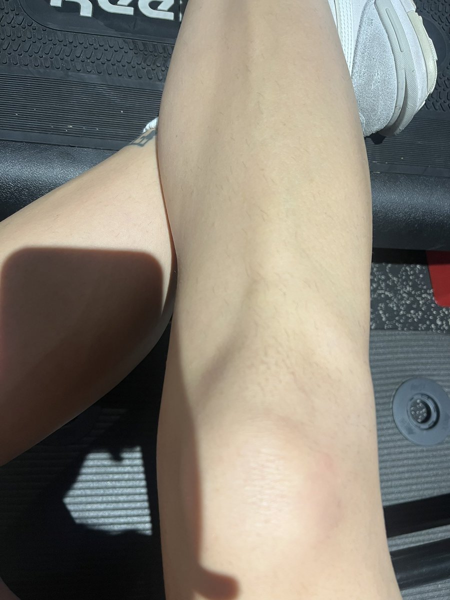 sammyb36's tweet photo. I’m here at Legs Bums &amp; Tums. My arch nemesis (ginger) is here and I’ve got hairy knees https://t.co/8u5KT5PdWD