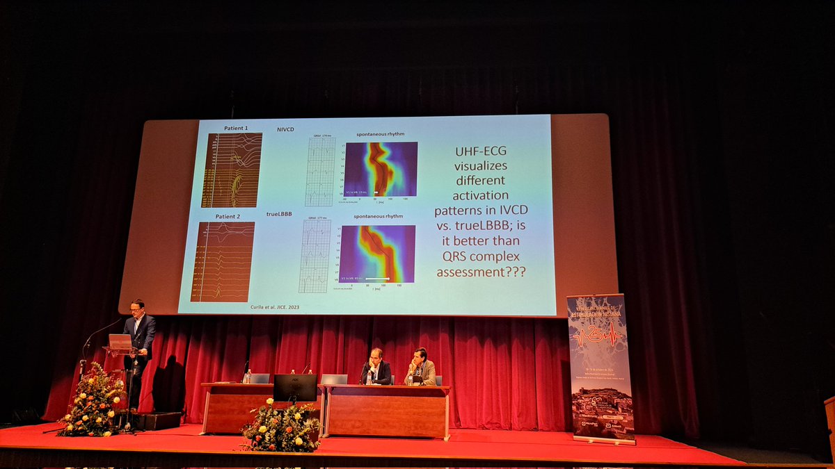 Teresa_Moraleda (@teremoraleda) on Twitter photo Enlightening session by <a href="/curilakarol/">curilakarol</a>: should we use UHF-ECG in every CSP implant? Real time and bed-side measure of ventricular synchrony as never seen before! <a href="/Dr_Pmorina/">Dr. Pablo Moriña Vázquez</a> <a href="/Irene_Esteve/">Irene Esteve</a> <a href="/josemig_carreno/">José Miguel Carreño Lineros</a> <a href="/Emilioamigo_/">Emilio Amigo</a> Enlightening session by <a href="/curilakarol/">curilakarol</a>: should we use UHF-ECG in every CSP implant? Real time and bed-side measure of ventricular synchrony as never seen before! <a href="/Dr_Pmorina/">Dr. Pablo Moriña Vázquez</a> <a href="/Irene_Esteve/">Irene Esteve</a> <a href="/josemig_carreno/">José Miguel Carreño Lineros</a> <a href="/Emilioamigo_/">Emilio Amigo</a>