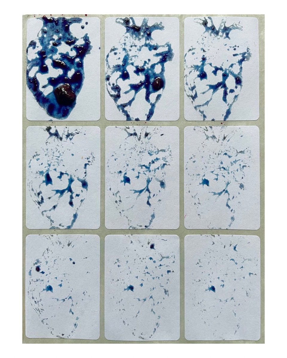 adrianepasa's tweet photo. “Blueberry hearts”

https://t.co/JTa098ibDI https://t.co/Y4TJq0zua9