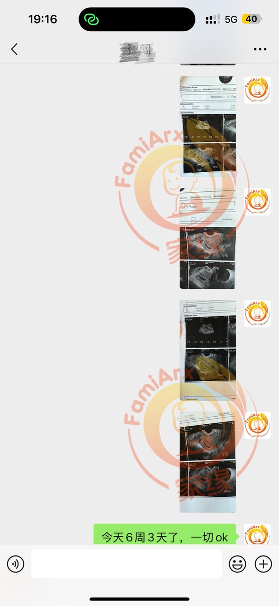 famiarx1's tweet photo. 图1️⃣2️⃣3️⃣： 6周3天的胎心啦❤️；图4️⃣5️⃣6️⃣： 35周4天的大宝贝；图7️⃣8️⃣9️⃣：23周3天的小宝贝👼🏻 https://t.co/tKTZJ2ryOK