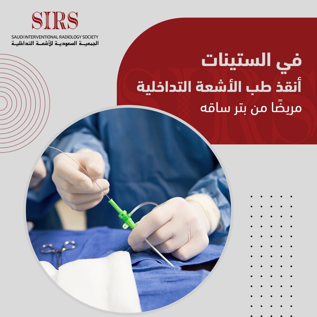 Saudi Interventional Radiology Society (@sirs_ksa) on Twitter photo هل تعلم؟
في الستينات،  مريض أنقذته الأشعة التداخلية من بتر ساقه تبرع بنصف مليون دولار لتطوير هذا التخصص! قصة تعكس قوة الابتكار والرغبة في مساعدة الآخرين
#SIRS
#Saudi_Interventional_Radiology_Society هل تعلم؟
في الستينات،  مريض أنقذته الأشعة التداخلية من بتر ساقه تبرع بنصف مليون دولار لتطوير هذا التخصص! قصة تعكس قوة الابتكار والرغبة في مساعدة الآخرين
#SIRS
#Saudi_Interventional_Radiology_Society