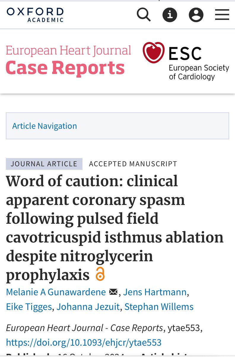 Melanie Gunawardene (@mel_gunawardene) on Twitter photo 🚨 Word of caution - find our case report from #StGeorgHeart published in EHJ CR
👉🏼Clinical apparent Coronary Spasm with a timely delay after PFA despite prior nitroglycerin
academic.oup.com/ehjcr/advance-…
<a href="/EHJCREiC/">EHJCaseReports Editor-in-Chief</a> <a href="/Phiso_de/">Philipp Sommer</a> <a href="/PrashSanders/">Prash Sanders</a> <a href="/jskoruth/">Jacob Koruth</a> <a href="/Dr_Santangeli/">Pasquale Santangeli</a> <a href="/Drdevignair/">Dr. Devi G Nair</a> 🚨 Word of caution - find our case report from #StGeorgHeart published in EHJ CR
👉🏼Clinical apparent Coronary Spasm with a timely delay after PFA despite prior nitroglycerin
academic.oup.com/ehjcr/advance-…
<a href="/EHJCREiC/">EHJCaseReports Editor-in-Chief</a> <a href="/Phiso_de/">Philipp Sommer</a> <a href="/PrashSanders/">Prash Sanders</a> <a href="/jskoruth/">Jacob Koruth</a> <a href="/Dr_Santangeli/">Pasquale Santangeli</a> <a href="/Drdevignair/">Dr. Devi G Nair</a>
