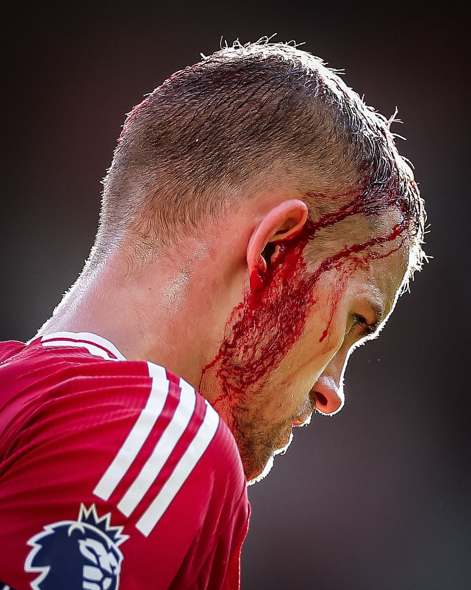 brfootball's tweet photo. Ouch. https://t.co/rGr4HvUTZN