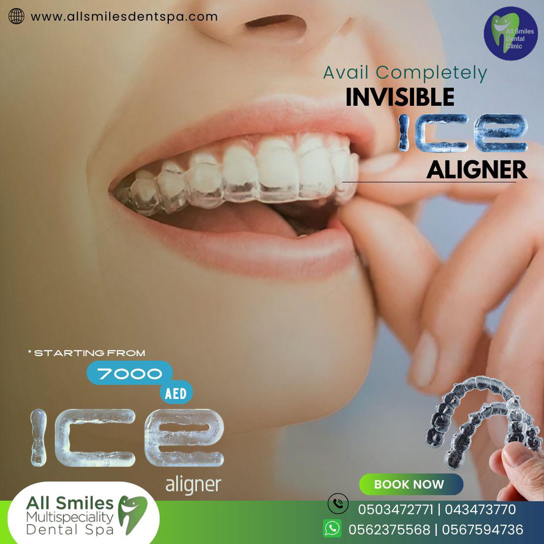AllSmilesDSpa's tweet photo. #ICE_ALIGNERS - All smiles multi specialty Dental Spa is a leading dental health provider in Dubai, United Arab Emirates, Best #Dental Clinic in #Dubai UAE #best #wisdomtooth #wisdomtoothremoval https://t.co/XW0BfICg5g