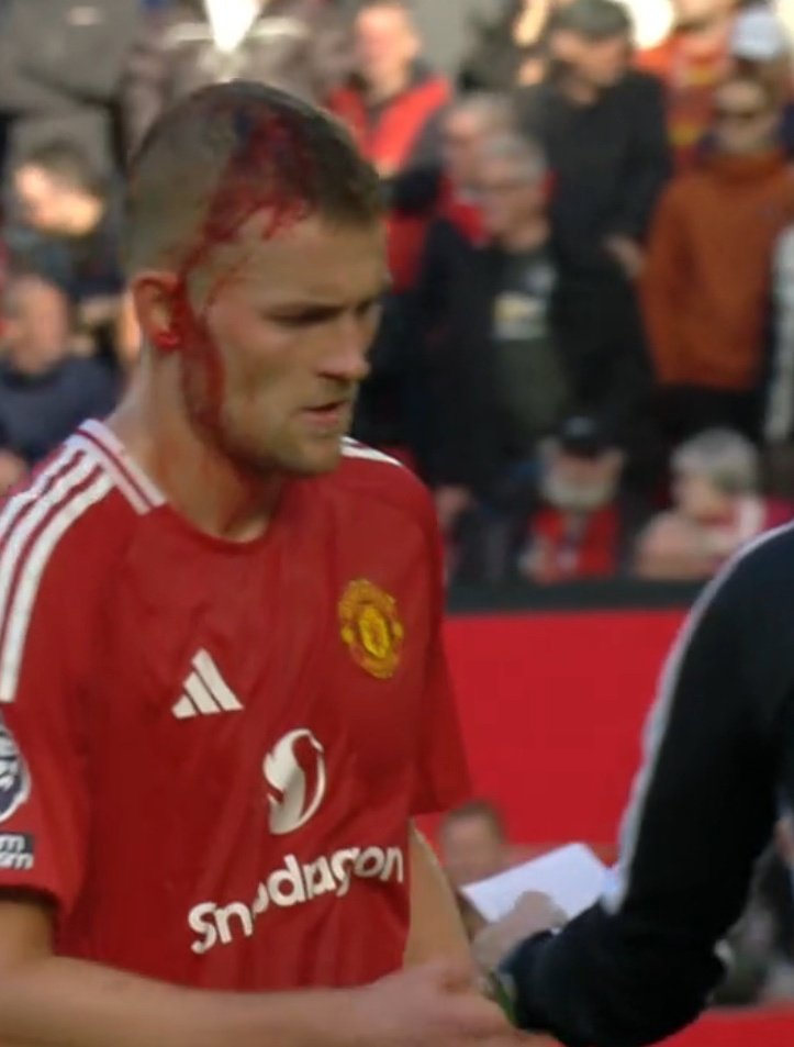 Would love to see the explanation from the <a href="/FA_PGMOL/">PGMO</a> to why Brentford won a free kick from this.