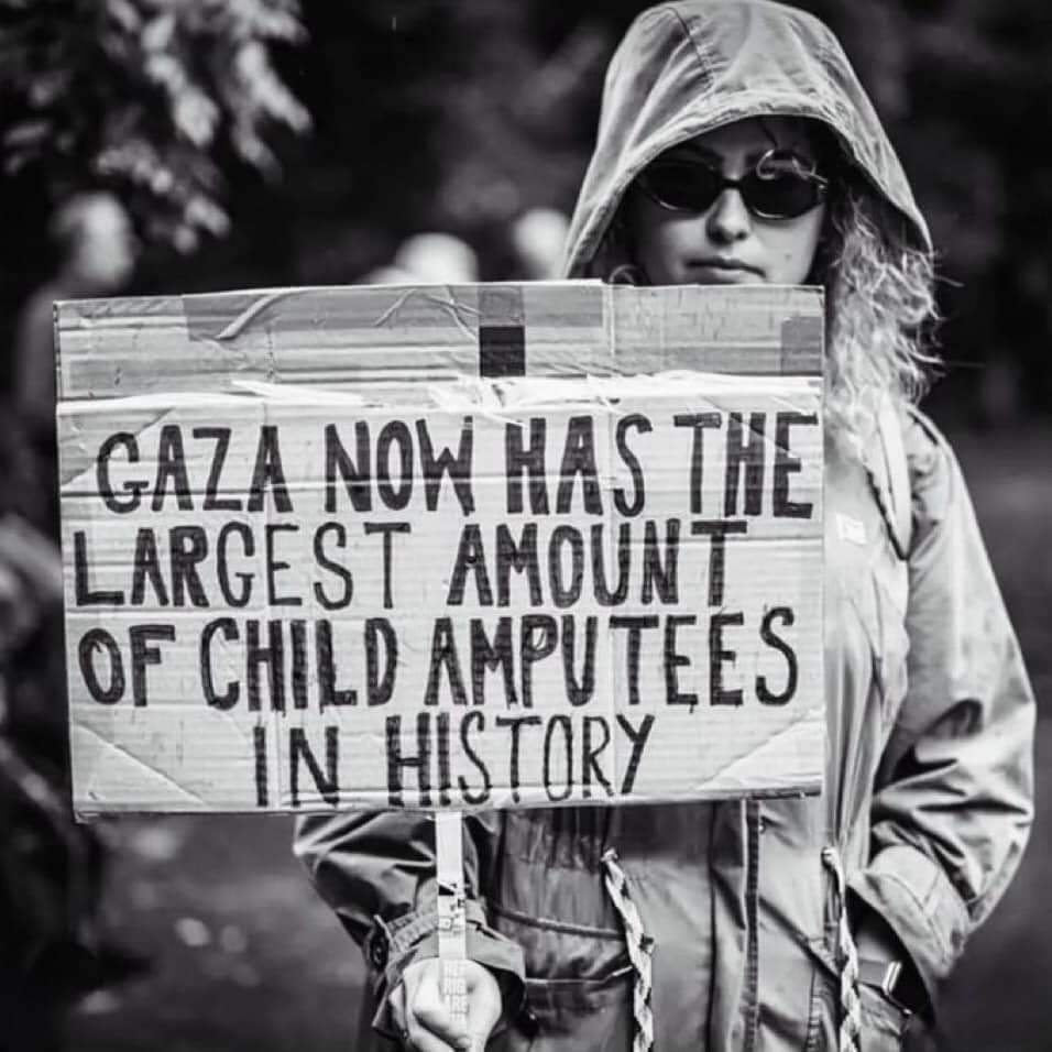 arayamas's tweet photo. ¡Gaza tiene ahora la mayor cantidad de niños amputados de la historia! https://t.co/8AaxbINbQz