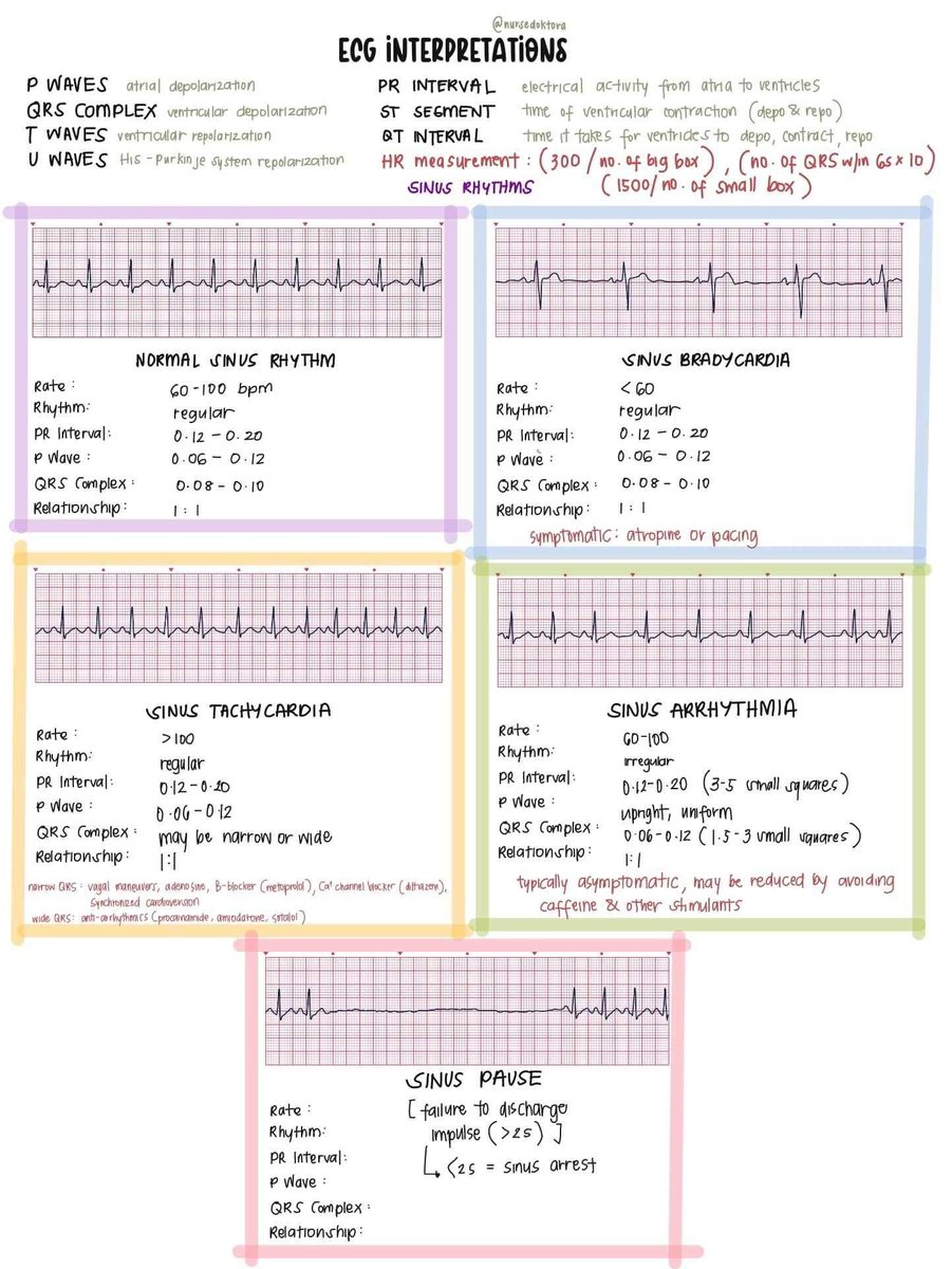 nursedoktora's tweet photo. bc this week na ang moving exam namin on ecg interpretations 🥲 itambak ko na to rito

[medyo] cheat sheet ! 

(ECG interpretations + usual treatments for them)

im yet to add junctional rhythms (pero pagod na lol maybe some other time if i still can) https://t.co/8bwcdsvxUH
