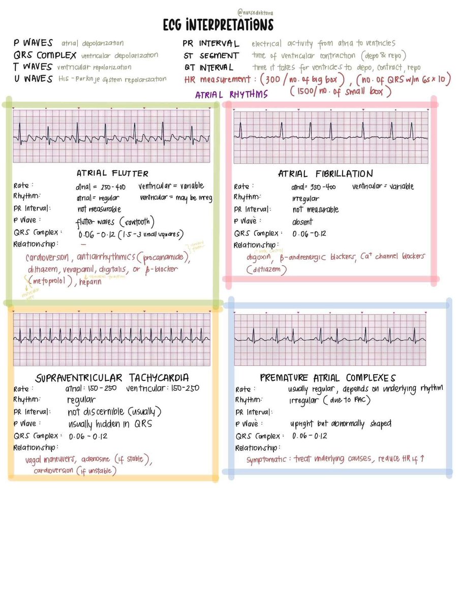 nursedoktora's tweet photo. bc this week na ang moving exam namin on ecg interpretations 🥲 itambak ko na to rito

[medyo] cheat sheet ! 

(ECG interpretations + usual treatments for them)

im yet to add junctional rhythms (pero pagod na lol maybe some other time if i still can) https://t.co/8bwcdsvxUH