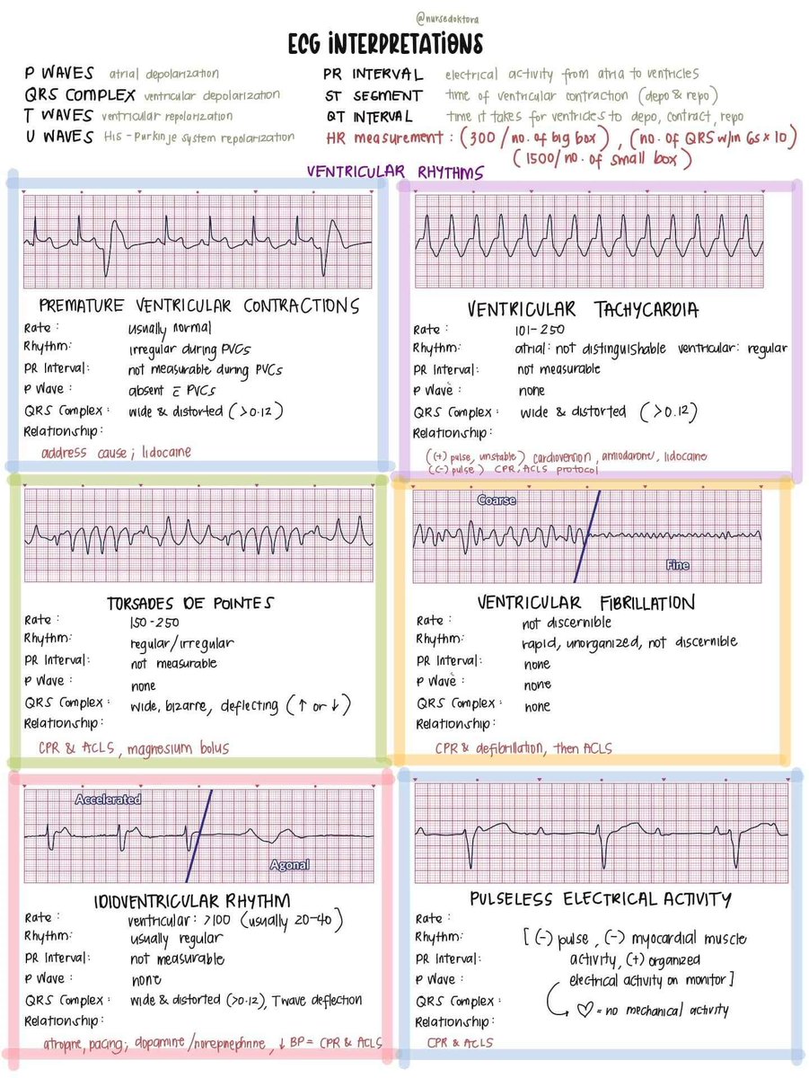 nursedoktora's tweet photo. bc this week na ang moving exam namin on ecg interpretations 🥲 itambak ko na to rito

[medyo] cheat sheet ! 

(ECG interpretations + usual treatments for them)

im yet to add junctional rhythms (pero pagod na lol maybe some other time if i still can) https://t.co/8bwcdsvxUH