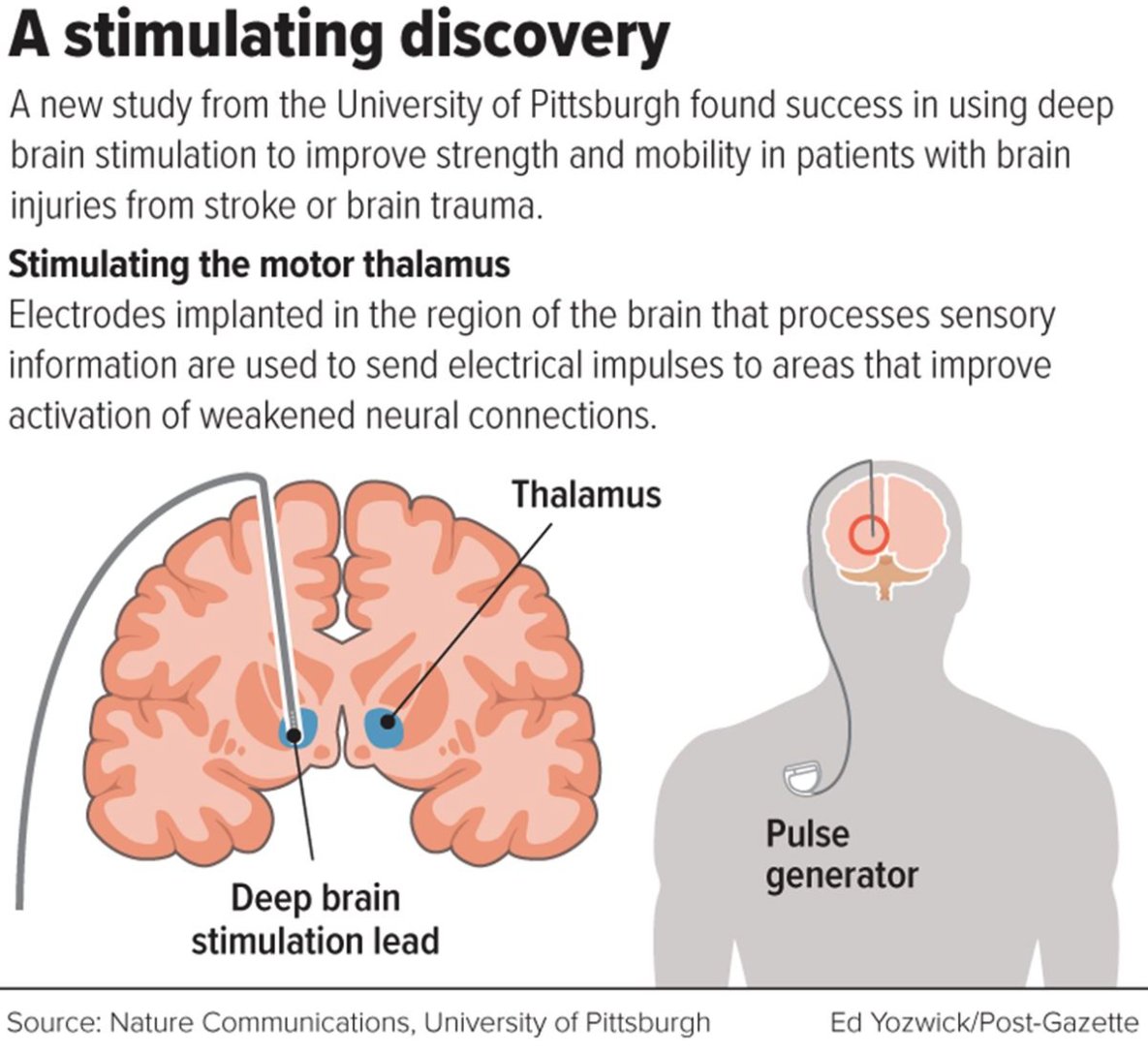 Pitt Neurosurgery (@pittneurosurg) on Twitter photo Brain injury patients gain arm, hand strength with deep brain stimulation, Pitt study finds. post-gazette.com/news/health/20… <a href="/ElviraPirondini/">Elvira Pirondini</a> <a href="/MCapogrosso/">Marco Capogrosso</a> Brain injury patients gain arm, hand strength with deep brain stimulation, Pitt study finds. post-gazette.com/news/health/20… <a href="/ElviraPirondini/">Elvira Pirondini</a> <a href="/MCapogrosso/">Marco Capogrosso</a>