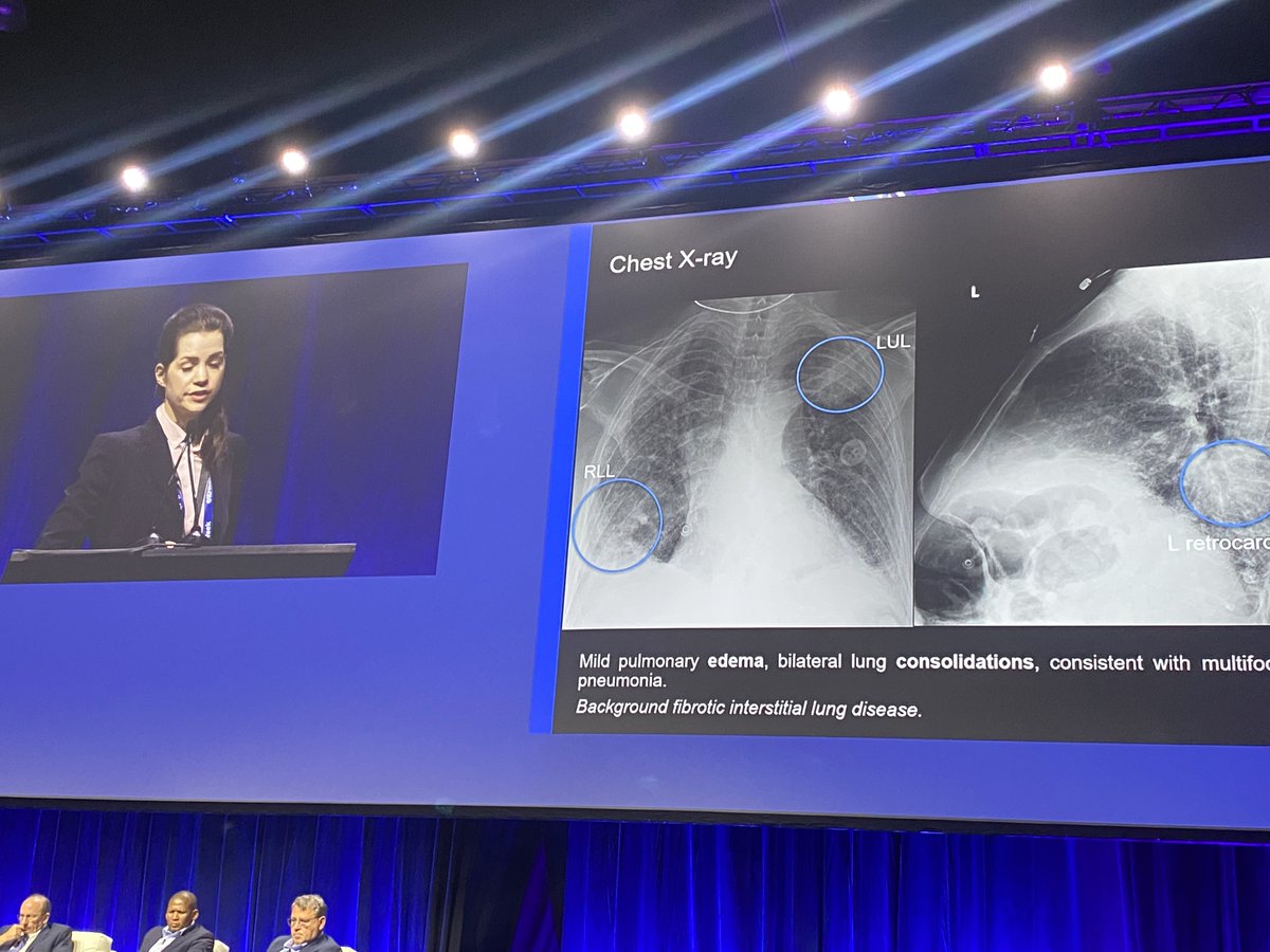 Yale ID Fellows (@yaleidfellows) on Twitter photo Not one, but TWO Challenging Case presentations by the fabulous Maria Koshy (2nd year fellow) and Lara Rotter <a href="/LaraKimR/">LaraKRotter</a> (3rd year IM resident) 2/5 Not one, but TWO Challenging Case presentations by the fabulous Maria Koshy (2nd year fellow) and Lara Rotter <a href="/LaraKimR/">LaraKRotter</a> (3rd year IM resident) 2/5