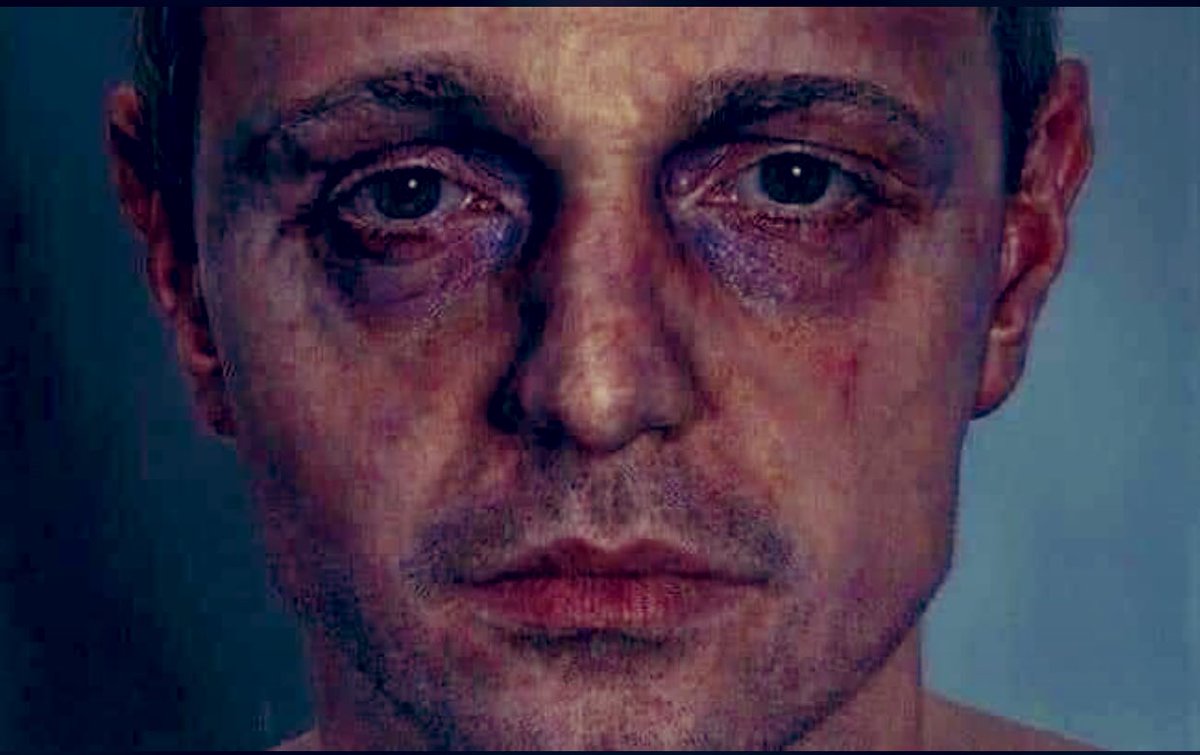 الخوف من المستقبل والتفكير فيه مهلك جداً🍂