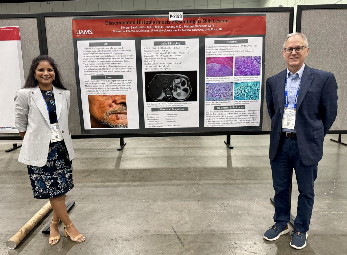 Srivani Sanikommu (@sanikommusri) on Twitter photo Great time connecting with my folks <a href="/UAMSInfDisease/">UAMS Infectious Diseases</a>, super proud of their accomplishments and happy to be part of it!! See u all next time…..<a href="/IDWeekmtg/">IDWeek</a> #IDtwitter <a href="/MichaelSaccent2/">Michael Saccente</a> <a href="/ryankdare/">Ryan</a> <a href="/KeyurVyasMD/">Keyur Vyas</a> Great time connecting with my folks <a href="/UAMSInfDisease/">UAMS Infectious Diseases</a>, super proud of their accomplishments and happy to be part of it!! See u all next time…..<a href="/IDWeekmtg/">IDWeek</a> #IDtwitter <a href="/MichaelSaccent2/">Michael Saccente</a> <a href="/ryankdare/">Ryan</a> <a href="/KeyurVyasMD/">Keyur Vyas</a>