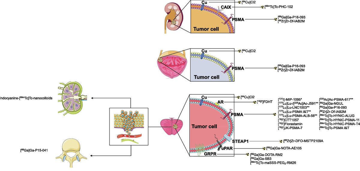 Michael Hofman (@drmhofman) on Twitter photo Novel Radiopharmaceuticals and Future of Theranostics in Genitourinary Cancers in <a href="/EUplatinum/">European Urology</a>
authors.elsevier.com/c/1jyul14kplyz…
Thanks Dr Martina Sollini <a href="/SanRaffaeleMI/">Ospedale San Raffaele</a> and co-authors: <a href="/CalaisJeremie/">Jeremie Calais</a> <a href="/drlouiseemmett/">Louise Emmett</a> <a href="/stefanofanti4/">prof. Stefano Fanti</a> <a href="/ProfKHerrmann/">Ken Herrmann</a> <a href="/thomashopemd/">Thomas Hope</a> <a href="/KidneyCancerDoc/">Brian Shuch, MD</a> Novel Radiopharmaceuticals and Future of Theranostics in Genitourinary Cancers in <a href="/EUplatinum/">European Urology</a>
authors.elsevier.com/c/1jyul14kplyz…
Thanks Dr Martina Sollini <a href="/SanRaffaeleMI/">Ospedale San Raffaele</a> and co-authors: <a href="/CalaisJeremie/">Jeremie Calais</a> <a href="/drlouiseemmett/">Louise Emmett</a> <a href="/stefanofanti4/">prof. Stefano Fanti</a> <a href="/ProfKHerrmann/">Ken Herrmann</a> <a href="/thomashopemd/">Thomas Hope</a> <a href="/KidneyCancerDoc/">Brian Shuch, MD</a>