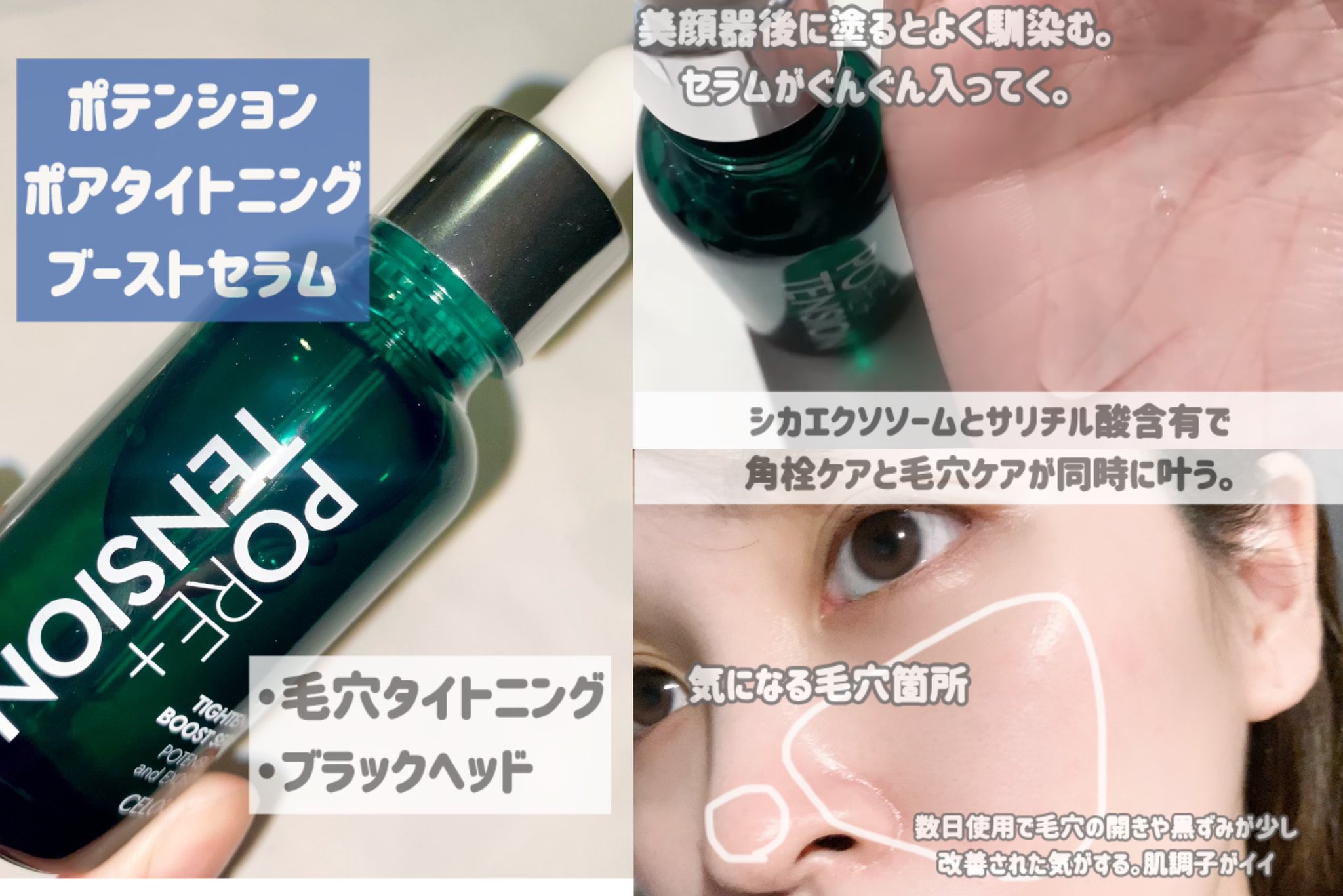 BIOPTRON 美顔器 Cタイトニングローション付き BIOPTRON 美顔器 Cタイトニングローション付き BIOPTRON 美顔器