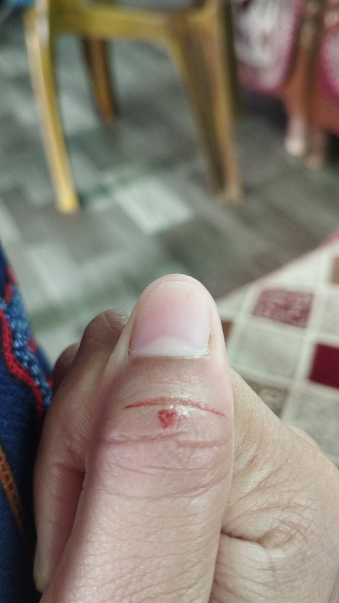 So this is love ❤️‍🩹