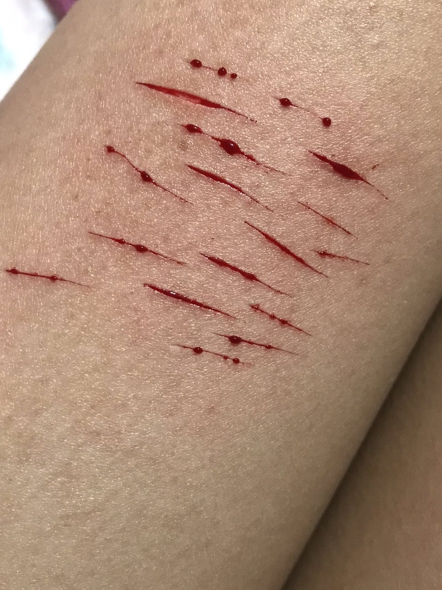 insanektty's tweet photo. después de cuatro meses creo que está bien #shtwt #sh https://t.co/VbddikW1YA