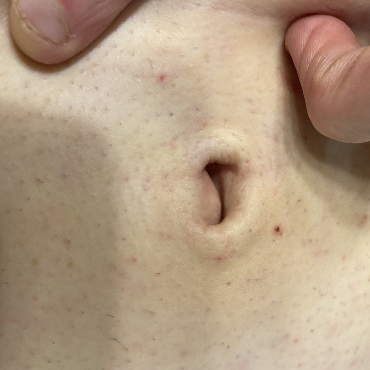 Belly____Button's tweet image. #bellybutton #inbetweenie