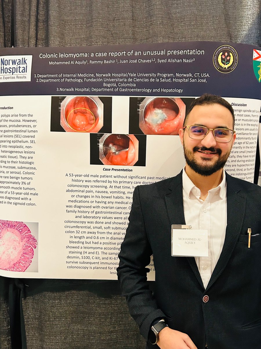 Mohammed Aquily (@mohdaquily1) on Twitter photo Honored to present our work at CT ACP conference Titled ( Colonic Leiomyoma: Case report of an unusual presentation) and represent <a href="/NHIMresidents/">Norwalk Hospital Internal Medicine Residency</a> along with my colleagues!!
I would also like to thank <a href="/juanchavesc/">Juan José Chaves</a> for the mentorship!
#ACP Honored to present our work at CT ACP conference Titled ( Colonic Leiomyoma: Case report of an unusual presentation) and represent <a href="/NHIMresidents/">Norwalk Hospital Internal Medicine Residency</a> along with my colleagues!!
I would also like to thank <a href="/juanchavesc/">Juan José Chaves</a> for the mentorship!
#ACP