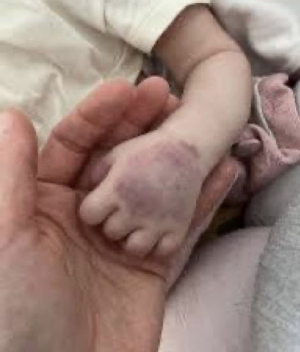 Bu dünya cehennem olduğu sürece, hiç kimse cennete gideceği yalanına inanmasın. İçim bir çocuğun kapıda kalmışlığı gibi…. #bebekkatilicetesi #yenidoğanbebekcetesi 
#oezelhastanelerkamulastırılsın #Sağlıkbakanistifa