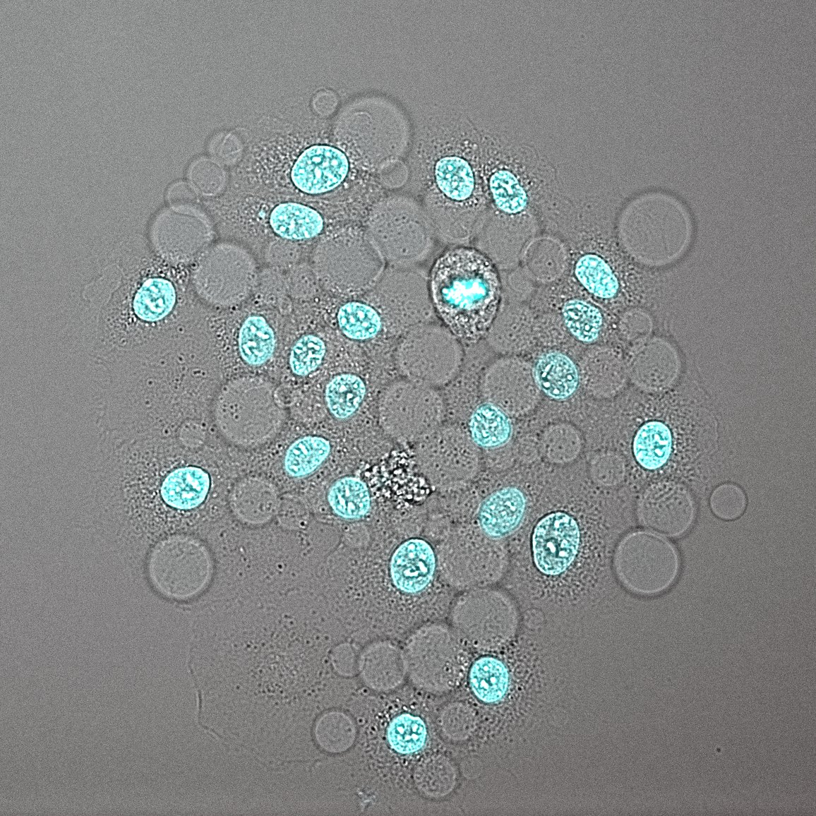 It is a bubbly cell day at the microscope
#CellDeath #PostdocLife