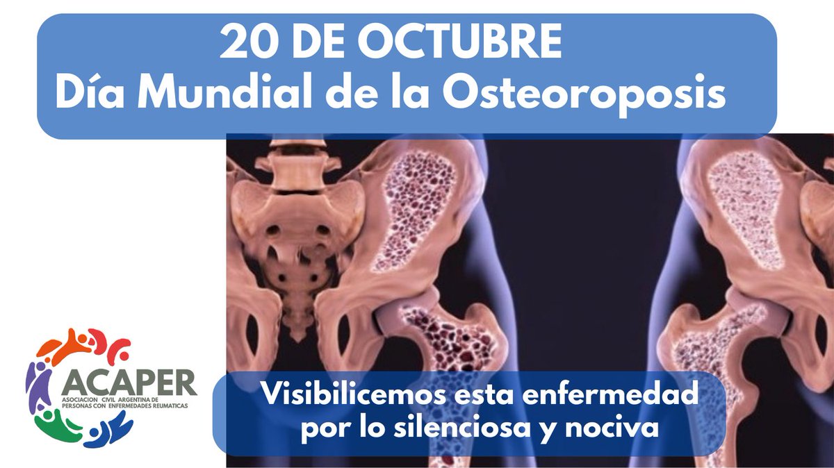 20 de octubre: Día Mundial de la Osteoporosis. Fue establecido con el objetivo de promover la prevención de la enfermedad y  concienciar la población.

#enfermedadesreumaticas #diamundialdelaosteoporosis #hagamosvisibleloinvisible #somosacaper