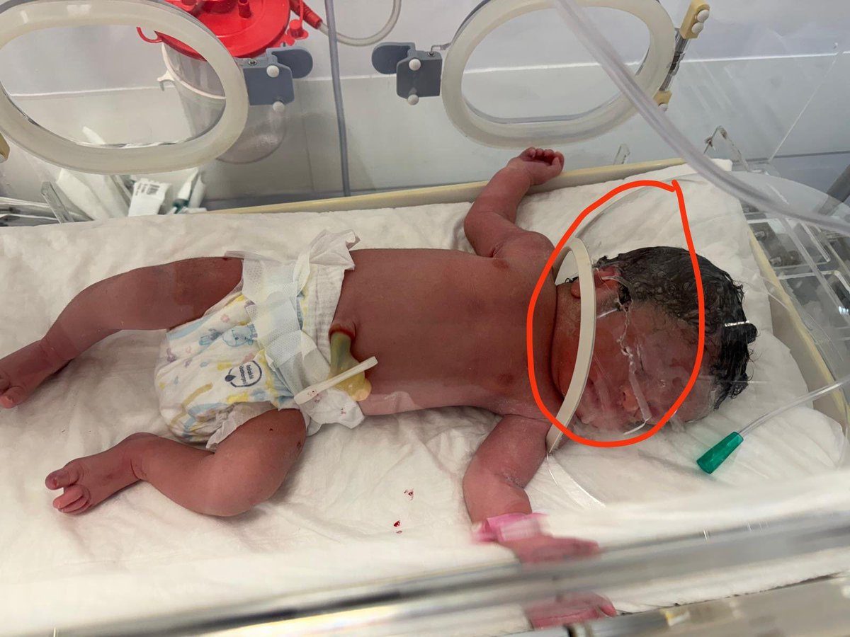 Yenidoğan bebek katillerinin hastanelerinde sistem hep aynı, sadece faillerin isimleri değişiyor!

Bir babanın feryadını sizlerle paylaşıyorum!

Bebeğini Bursa’da ihmaller zinciriyle dolu özel bir hastanenin yoğun bakımında kaybetmiş bir baba olarak yazıyorum…
Eşim, 14