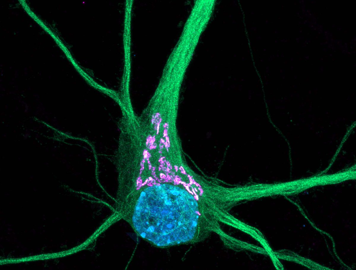 Lorena Benedetti (@lorenabenedet15) on Twitter photo โจ Excited to kick off #CellSpeak with <a href="/ASCBiology/">American Society for Cell Biology</a>! Letโs dive into the breathtaking world of cellsโtiny universes shaping life, health, and discovery. ๐ฌ
I'll start with my favorite cell: a neuron (microtubules in green, Golgi complex in magenta, and nucleus in blue). ๐ง ๐ โจ Excited to kick off #CellSpeak with <a href="/ASCBiology/">American Society for Cell Biology</a>! Letโs dive into the breathtaking world of cellsโtiny universes shaping life, health, and discovery. ๐ฌ
I'll start with my favorite cell: a neuron (microtubules in green, Golgi complex in magenta, and nucleus in blue). ๐ง ๐
